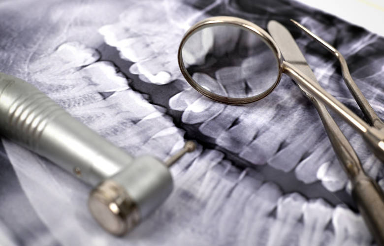 5 βασικοί λόγοι που ο οδοντίατρος χρειάζονται την πανοραμική ακτινογραφία