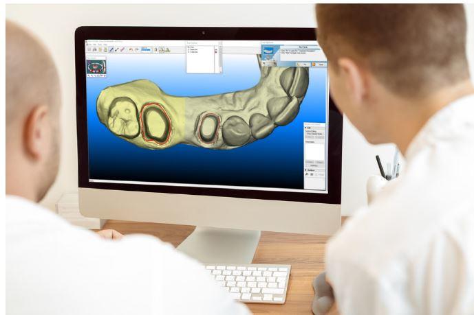 iTero Element®Scanner: Η καθολική λύση για το ψηφιακό οδοντιατρείο!